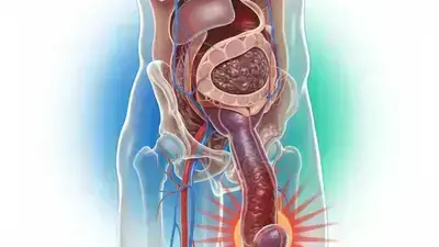 Długotrwała erekcja: Kiedy jest to sygnał alarmowy?
