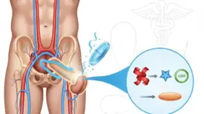 Tabletki na potencję: Mechanizm działania i zastosowanie